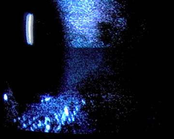 Philipp Rosenbecks Augen-Element